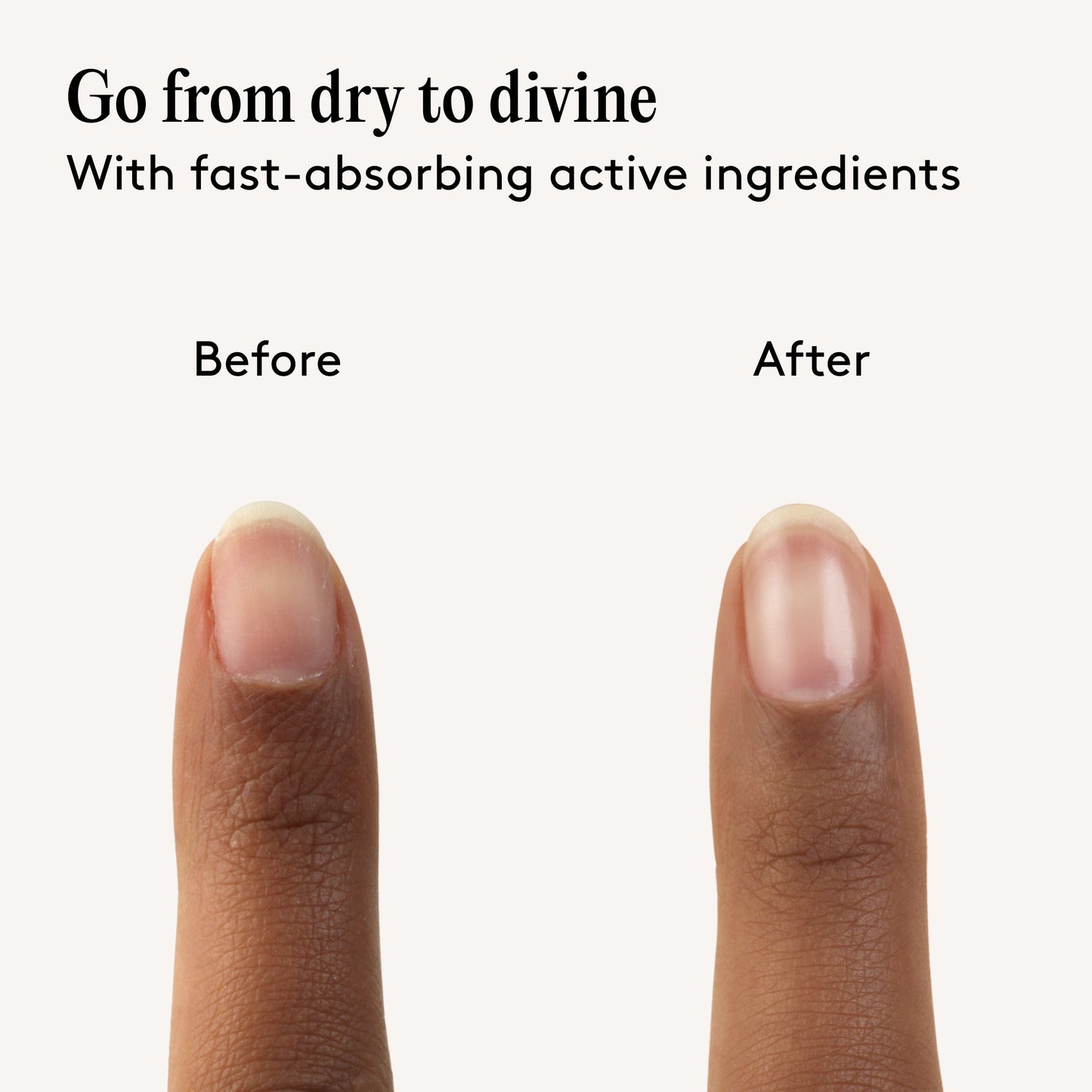 Mylee Treat Your Tips Care Kit